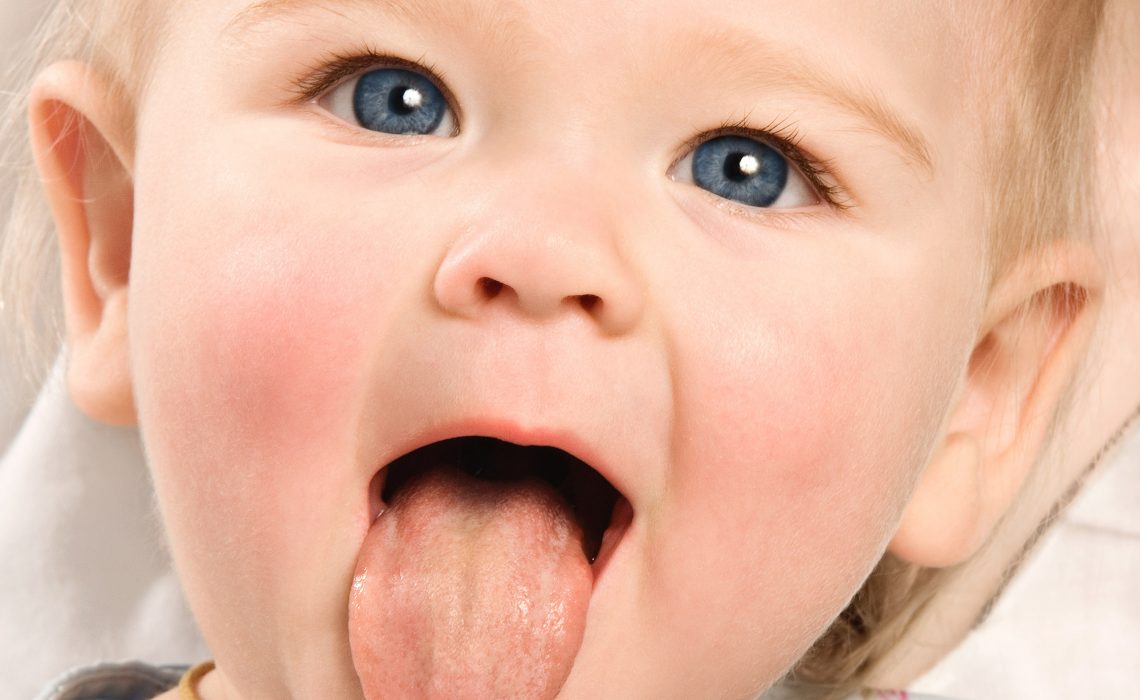 Tongue Tied Babies – Problems and Corrections